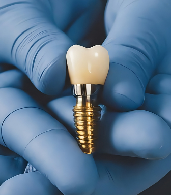 dental implant