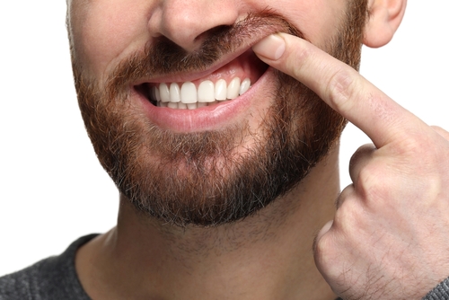 man showing healthy teeth